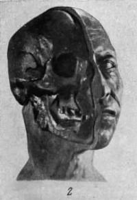 Restoration of Timur's head.